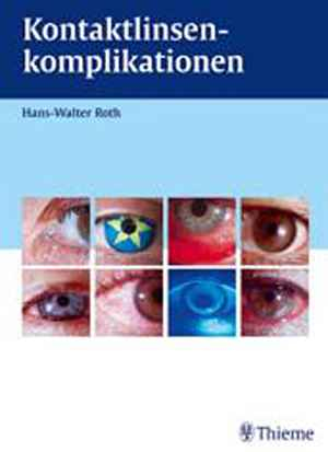 Kontaktlinsenkomplikationen
