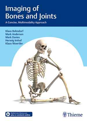 Imaging of Bones and Joints: A Concise, Multimodality Approach  1st