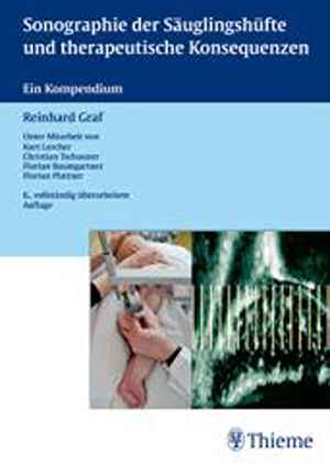 Sonographie der Säuglingshüfte und therapeutische Konsequenzen