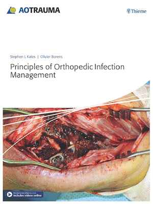 Principles of Orthopedic Infection Management