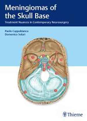 Meningiomas of the Skull Base: Treatment Nuances in Contemporary Neurosurgery 1st