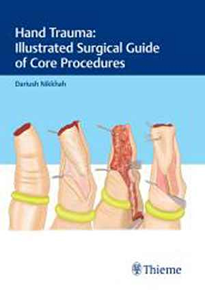 Hand Trauma: Illustrated Surgical Guide of Core Procedures  1st