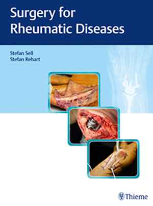 Surgery for Rheumatic Diseases  1st