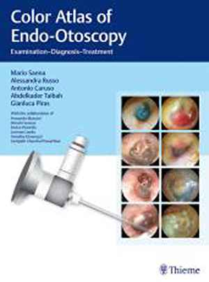 Color Atlas of Endo-Otoscopy: Examination - Diagnosis - Treatment  1st