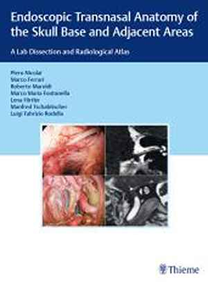 Endoscopic Transnasal Anatomy of the Skull Base and Adjacent Areas: A Lab Dissection and Radiological Atlas  1st
