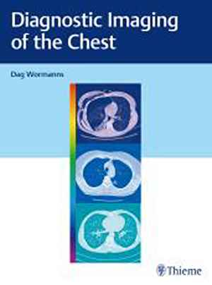 Diagnostic Imaging of the Chest  1st