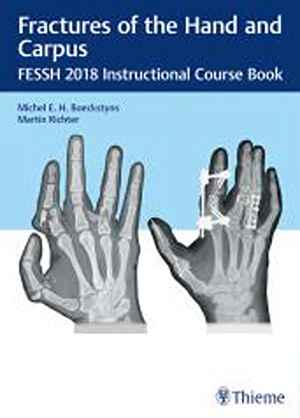 Fractures of the Hand and Carpus: FESSH 2018 Instructional Course Book  1st