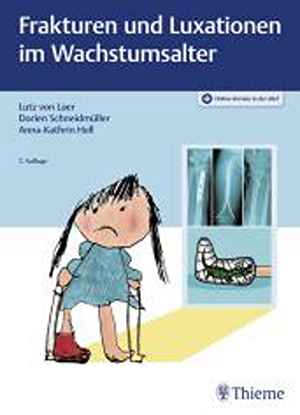 Frakturen und Luxationen im Wachstumsalter
