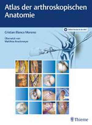 Atlas der arthroskopischen Anatomie