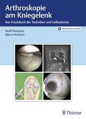 Arthroskopie am Kniegelenk
