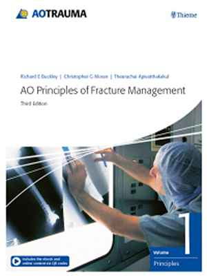 AO Principles of Fracture Management: Vol. 1: Principles, Vol. 2: Specific fractures  3rd