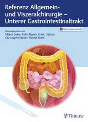 Referenz Allgemein- und Viszeralchirurgie – Unterer Gastrointestinaltrakt