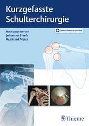 Kurzgefasste Schulterchirurgie