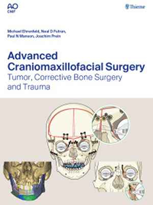 Advanced Craniomaxillofacial Surgery: Tumor, Corrective Bone Surgery, and Trauma  1st