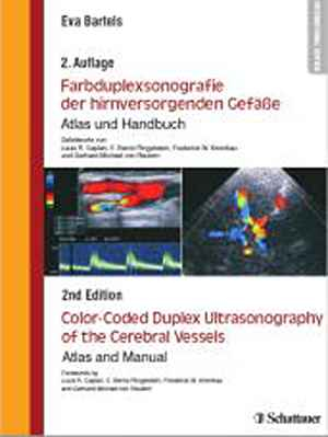 Farbduplexsonografie der hirnversorgenden Gefäße