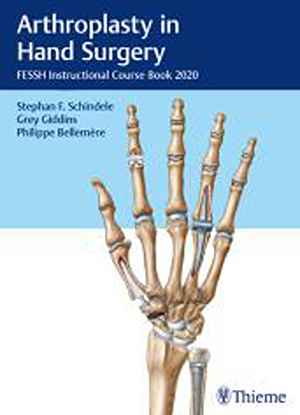 Arthroplasty in Hand Surgery: FESSH Instructional Course Book 2020  1st