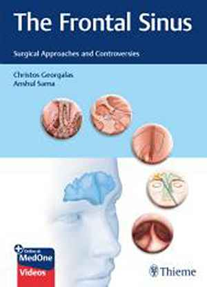 The Frontal Sinus: Surgical Approaches and Controversies  1st