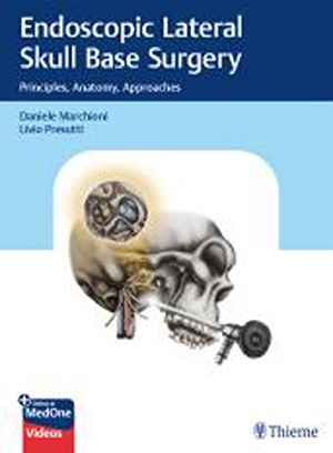 Endoscopic Lateral Skull Base Surgery: Principles, Anatomy, Approaches  1st