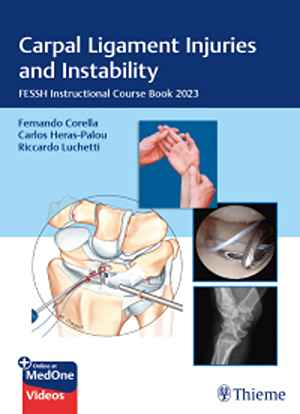 Carpal Ligament Injuries and Instability: FESSH Instructional Course Book 2023 1st