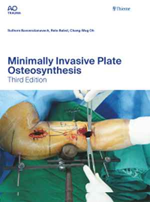 Minimally Invasive Plate Osteosynthesis  3rd