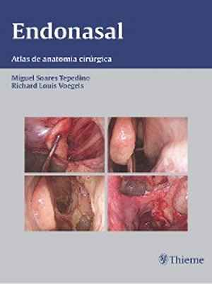 Endonasal