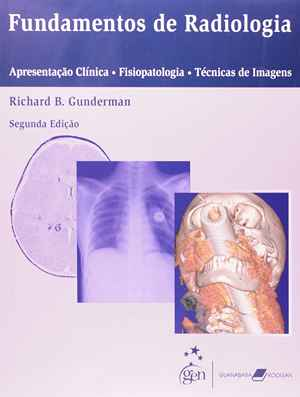 Fundamentos De Radiologia. Apresentação Clínica. Fisiopatologia. Técnicas De Imagem
