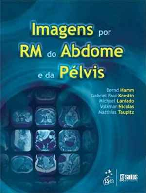 Imagens Por Ressonancia Magnetica Do Abdome E Pelvis