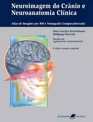 Neuroimagem do Crânio e Neuroanatomia Clinica