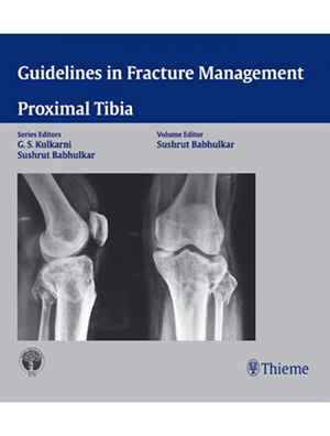 Guidelines in Fracture Management