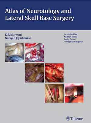 Atlas of Neurotology and Lateral Skull Base Surgery