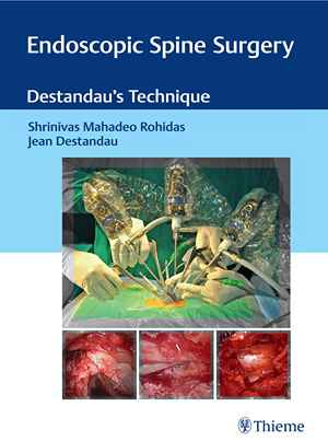 Endoscopic Spine Surgery