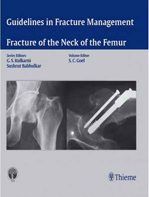 Guidelines in Fracture Management