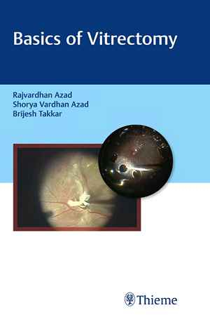 Basics of Vitrectomy
