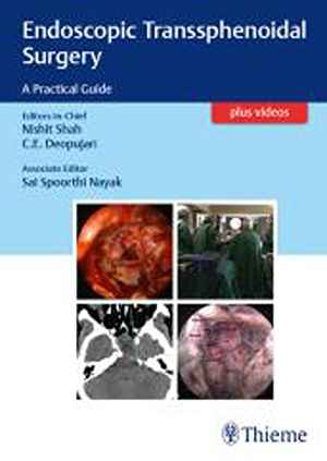 Endoscopic Transsphenoidal Surgery
