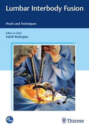 Lumbar Interbody Fusion: Pearls and Techniques 1st