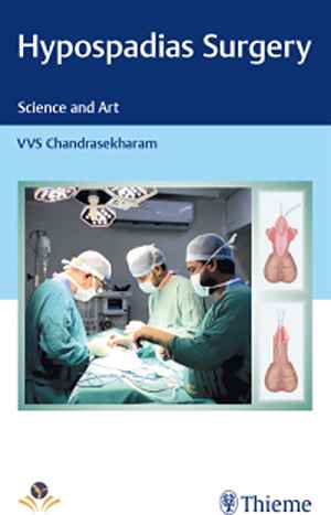 Hypospadias Surgery: Science and Art  1st