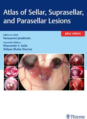 Atlas of Sellar, Suprasellar, and Parasellar Lesions  1st