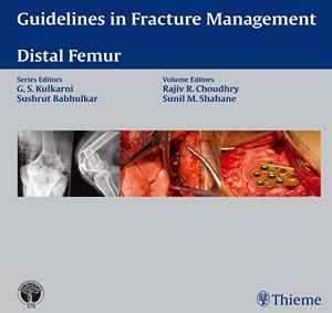 Guidelines in Fracture Management