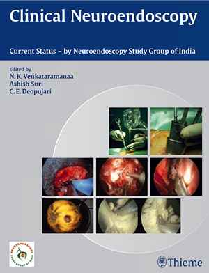 Clinical Neuroendoscopy