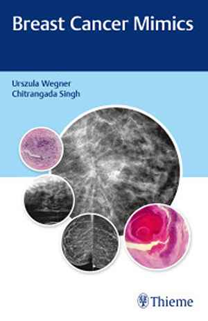 Breast Cancer Mimics  1st