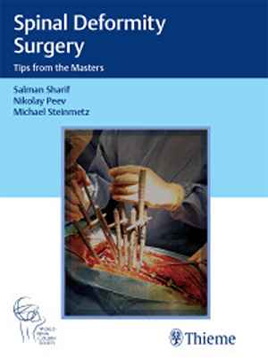 Spinal Deformity Surgery: Tips from the Masters  1st