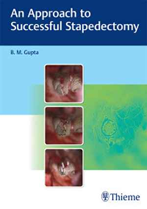 An Approach to Successful Stapedectomy 1st
