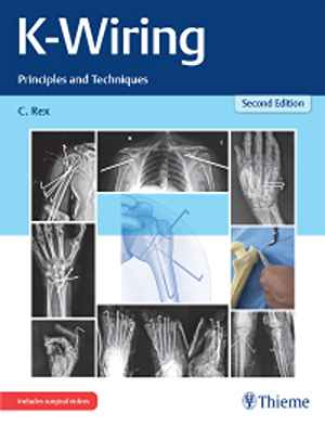 K-Wiring: Principles and Techniques 2nd