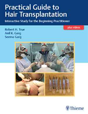 Practical Guide to Hair Transplantation: Interactive Study for the Beginning Practitioner 1st