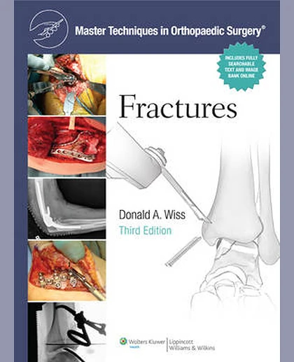 Fractures
