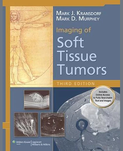Imaging of Soft Tissue Tumors