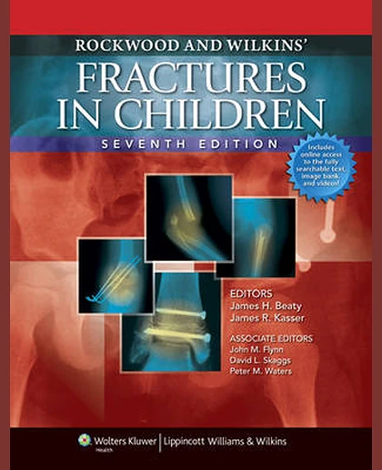 Rockwood and Wilkins' Fractures in Children