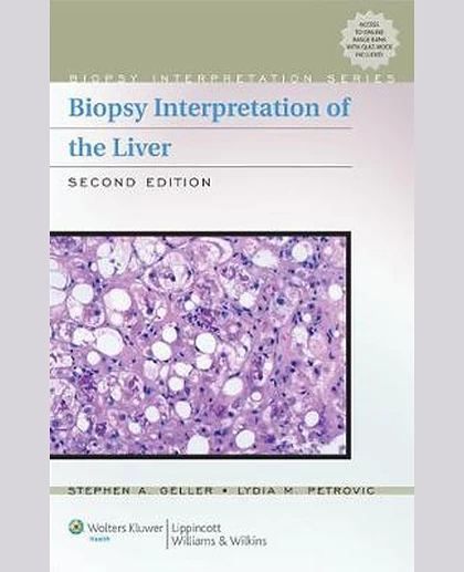 Biopsy Interpretation of the Liver