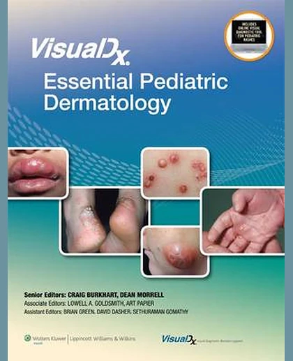 VisualDx: Essential Pediatric Dermatology