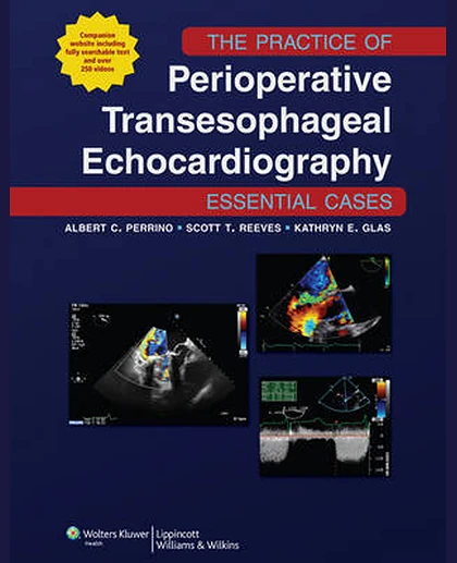 The Practice of Perioperative Transesophageal Echocardiography: Essential Cases